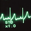 EKG EKG