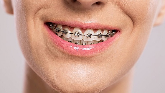 Tandbøjle Tandbøjle